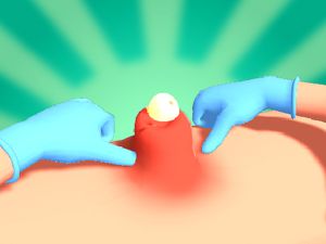 Spil Pimple Squeeze online